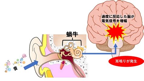 耳鳴 時間|耳鳴りとは？代表的な原因や症状、治療法、受診のタ。